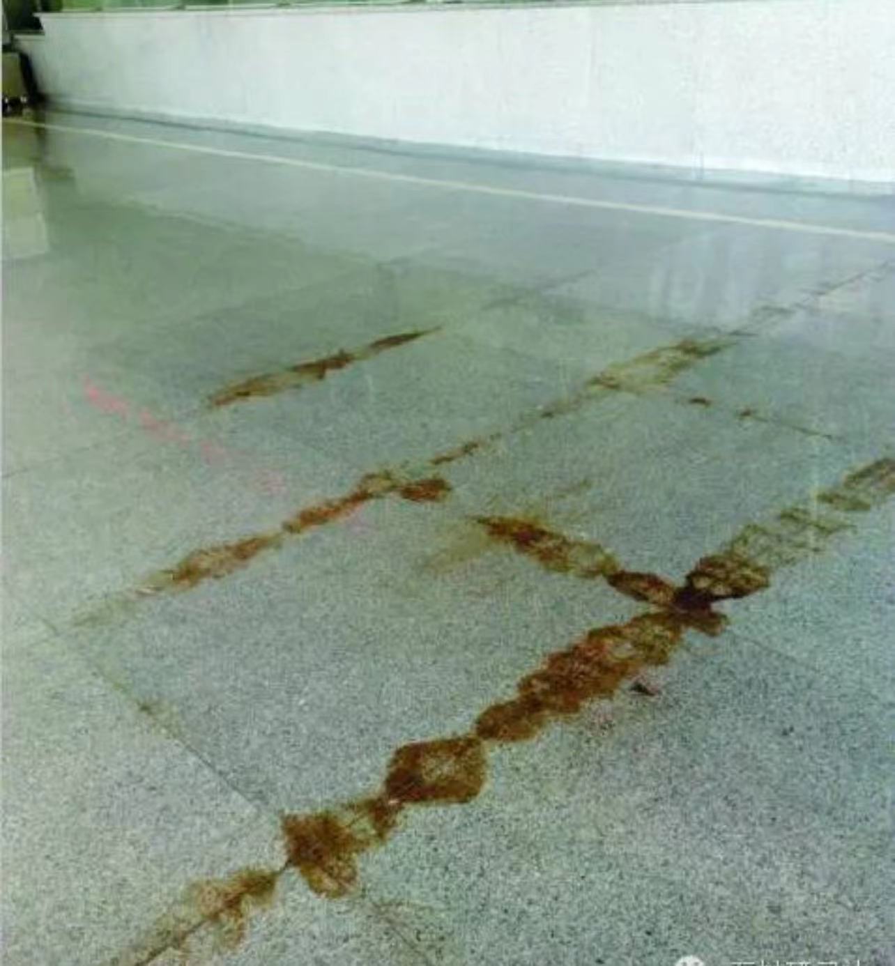 大理石病变处理